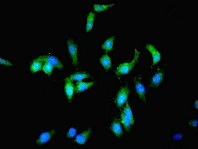 PCK1 Antibody